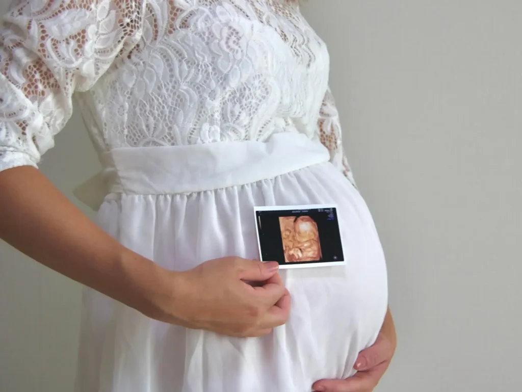 エコー写真を使ったマタニティフォト